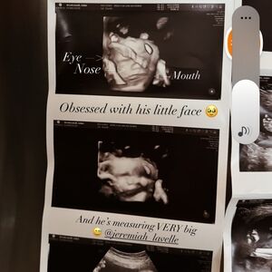 Black and White Ultrasound Photo Collection